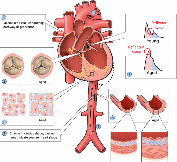 Vascular aging